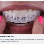 Desensibilize KF | FGM - Image 2
