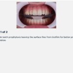 Desensibilize KF | FGM - Image 3