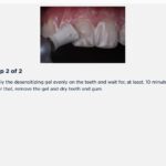 Desensibilize KF | FGM - Image 4