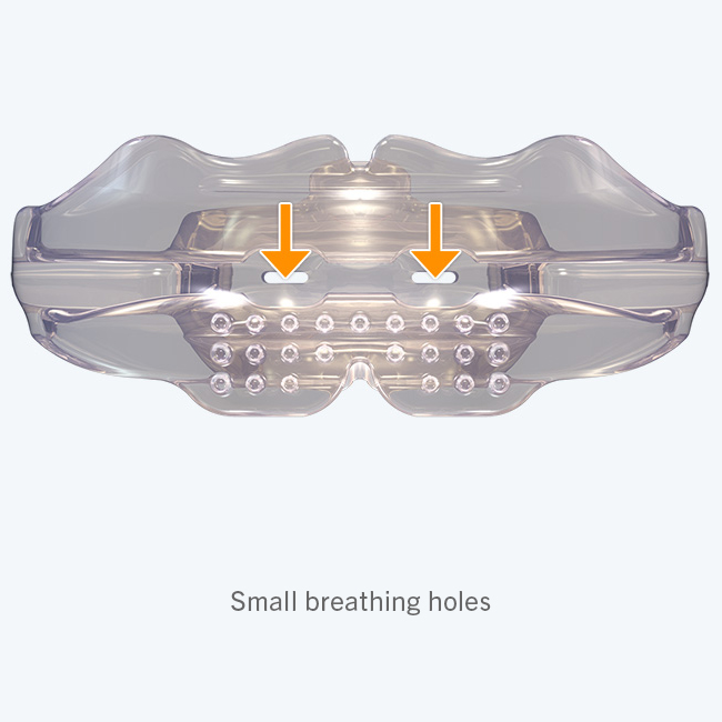 Myobrace for Adults Stage One - A1 - Image 5