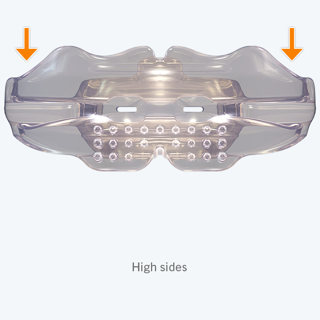 Myobrace for Adults Stage One - A1 - Image 9
