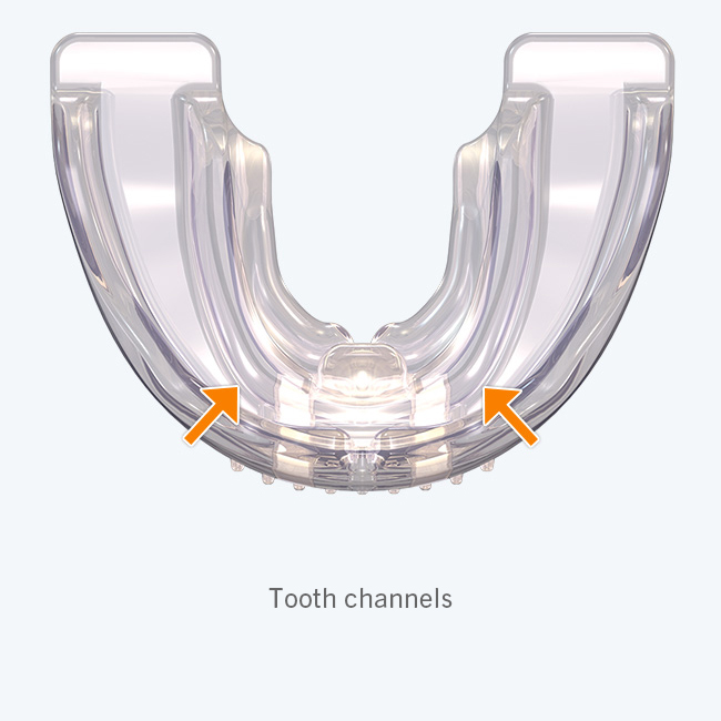 Myobrace for Adults Stage One - A1 - Image 4