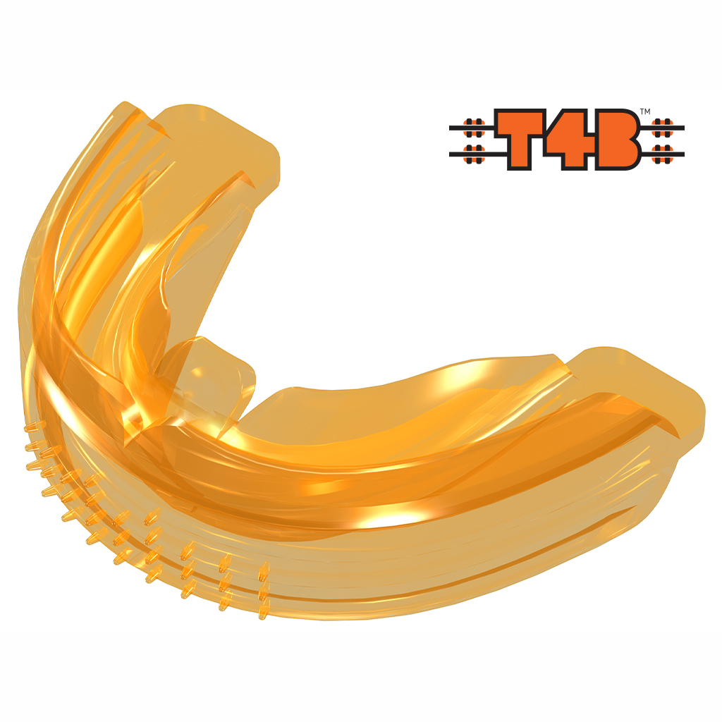 The Trainer System - Trainer for Braces Phase 1